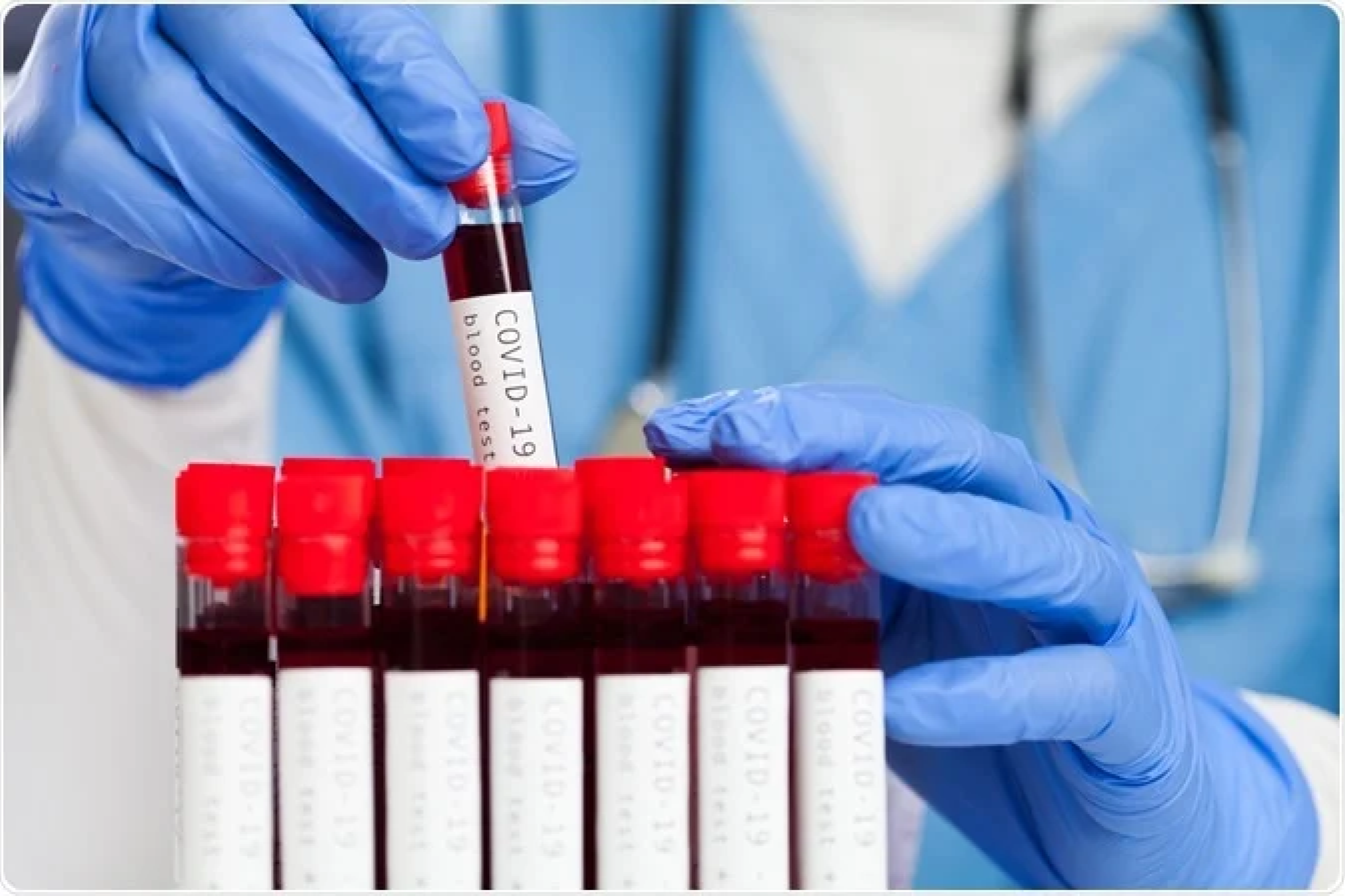 CovCare Serology Test Package